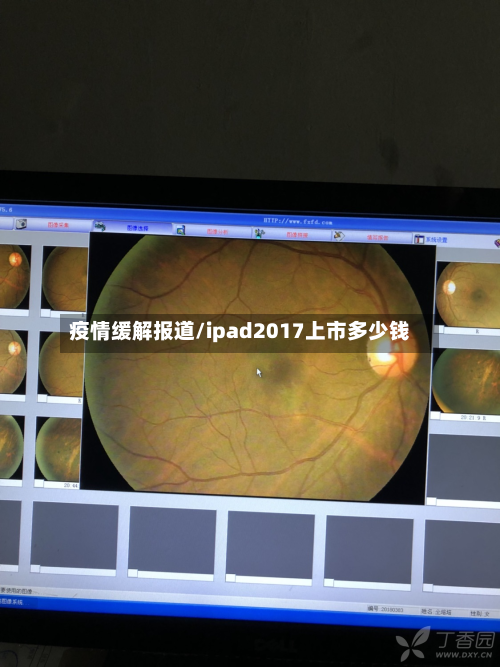 疫情缓解报道/ipad2017上市多少钱