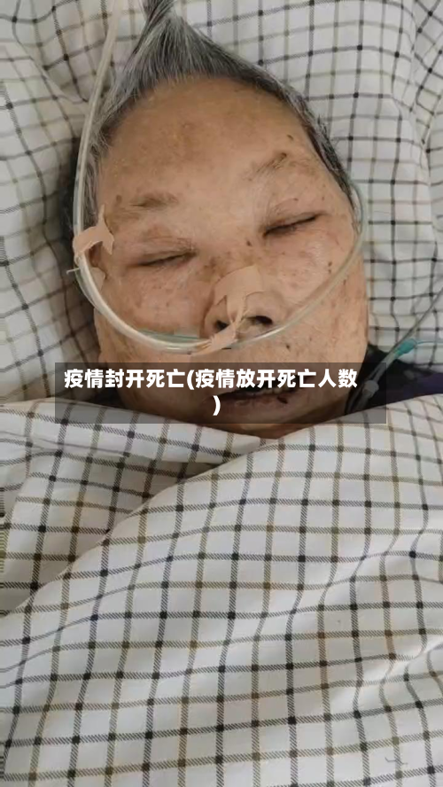 疫情封开死亡(疫情放开死亡人数)-第3张图片