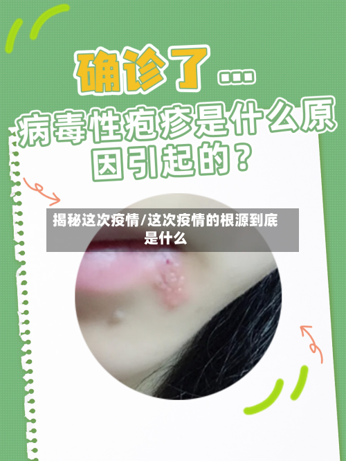 揭秘这次疫情/这次疫情的根源到底是什么